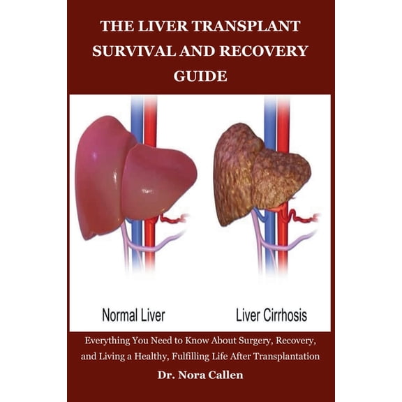The Liver Transplant Survival and Recovery Guide: Everything You Need to Know About Surgery, Recovery, and Living a Heal, (Paperback)