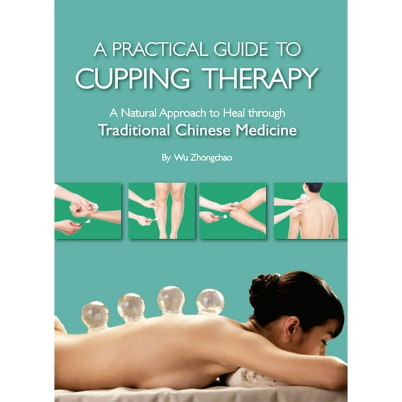 Practical Guide to Cupping Therapy: A Natural Approach to Heal Through Traditional Chinese Medicine, (Paperback)