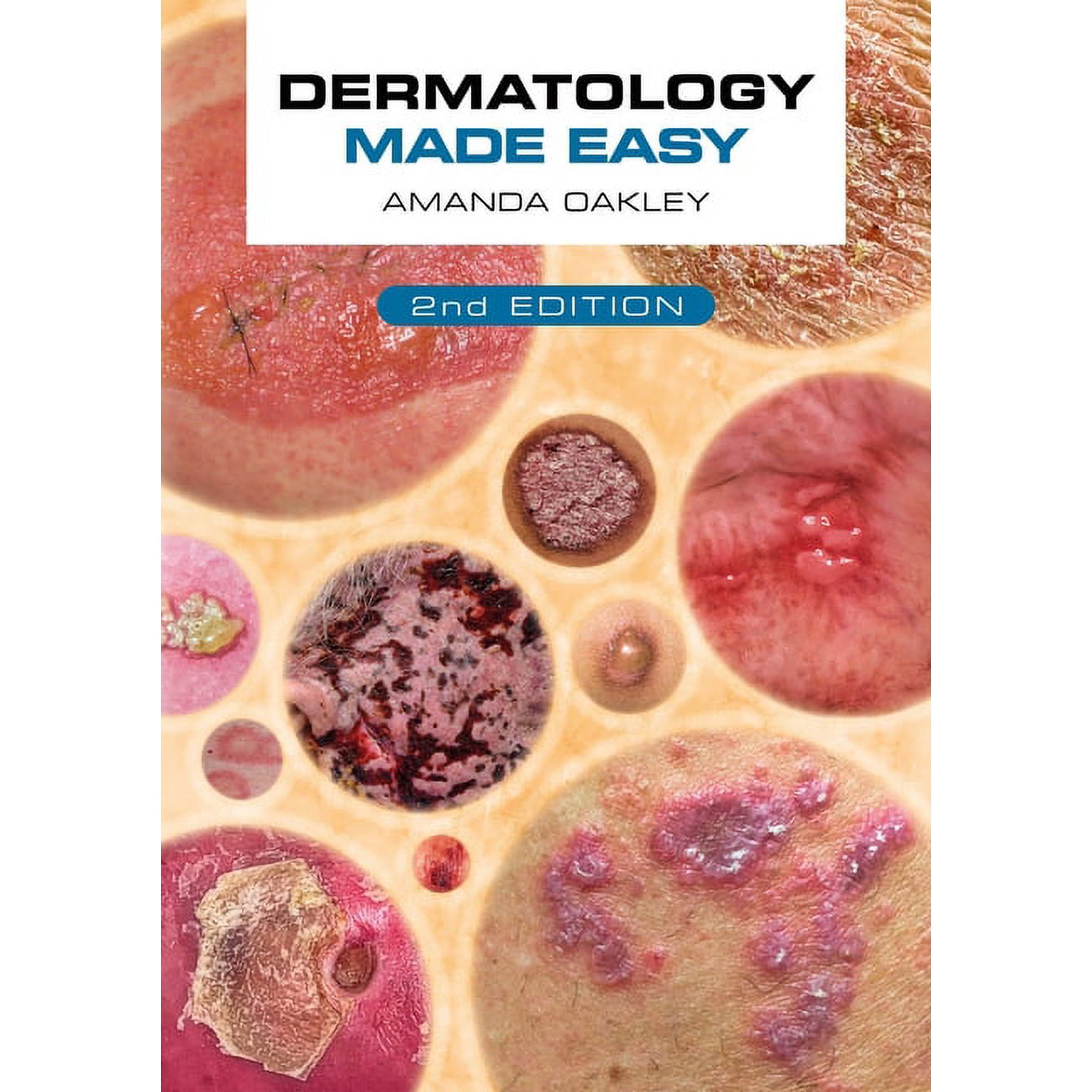Dermatology Made Easy, Second Edition, (Paperback)