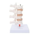 thumbnail image 1 of Anatomical Spine Model, Eco-friendly Anatomical Osteoporosis Model Safe Durable  For Model Display For Teaching For Doctor-patient Explanation, 1 of 8