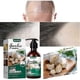 thumbnail image 3 of Jaysuing Garlic Shampoo Hair Cleaning Shampoo Moisturizing Head And Tail Hair Care - 100Ml, 3 of 5