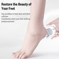 thumbnail image 3 of Electric Foot Callus Remover with 2 Grinding Heads - USB Rechargeable, 120-Min Battery, Removable Washable Head, One-Button Start - ABS Material, 800mAh Lithium Battery, 2.0W Power - White Standard, 3 of 6