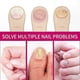 thumbnail image 4 of Ginger Infusion Nail Repair - Fortifies Toenails and Restores Smoothness for Optimal Nail Health, 4 of 5