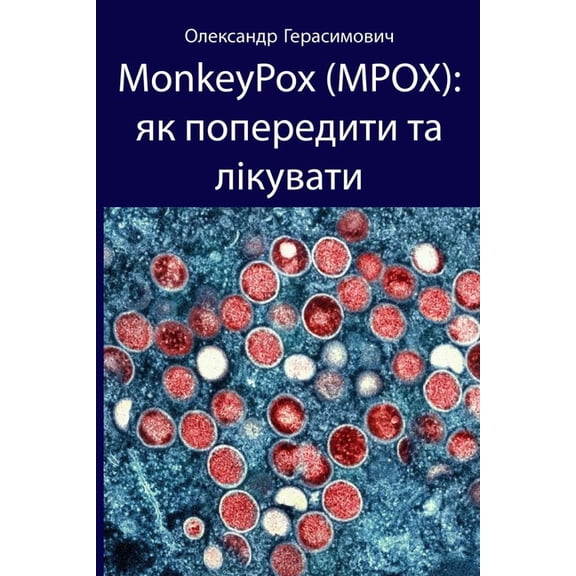 MonkeyPox (MPOX): як поперед&a, (Paperback)