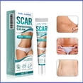 thumbnail image 3 of Eliminación de cicatrices para cicatrices de acné, estrías, cicatrices de cesárea y cicatrices de quemaduras, cicatrices de corte para cicatrices viejas y nuevas para rostro y cuerpo 20 ml, 3 of 4