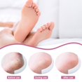 thumbnail image 4 of Vogacara Lima para pies de grado profesional, color negro, 50x, para pedicuras seguras e higiénicas, escofina para pies suave y pulida Cuidado de los pies, 4 of 6