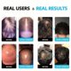 thumbnail image 3 of Tomshoo Crecimiento del pelo, relajación del pelo Modos de uso del pelo 5 Rojo y Compresión Uso de la función Compresión Uso de 3 Mujeres Hombres Relajación Hombres 3 Modos, 3 of 8
