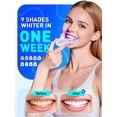 thumbnail image 2 of Kit de blanqueamiento dental OLLM Professional con peróxido de carbamida al 35%, 2 of 7