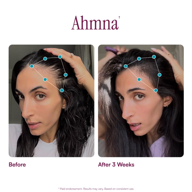 Purity Products MyBiotin ProClinical with Astaxanthin photo 6