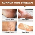 thumbnail image 6 of Aliver Cracked Heel Repair Balm, Balm for Rough Heels, For Dry Skin & Cracked Feet Hydration,(Coconut)2.46oz, 6 of 9
