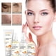 thumbnail image 1 of Fiudx Liquidación De Ahorros De Verano Cúrcuma Skin Set Crema De Cúrcuma + Cúrcuma + Manteca De Cúrcuma + Limpiador Facial De Cúrcuma + Mascarilla De Barro De Cúrcuma 60Ml, 1 of 6