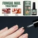 thumbnail image 3 of Solución para el cuidado de las uñas de los pies, tratamiento para uñas dañadas, renueva las uñas de los pies dañadas y descoloridas (15 ml), 3 of 3