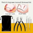 thumbnail image 2 of Toenail Clippers for Thick Toenails - Heavy Duty   Clipper Kit for Ingrown Toenails, Stainless Steel  Nippers with Non-Slip Rubber Handle, with Lifter & File and Travel Bag, 2 of 6