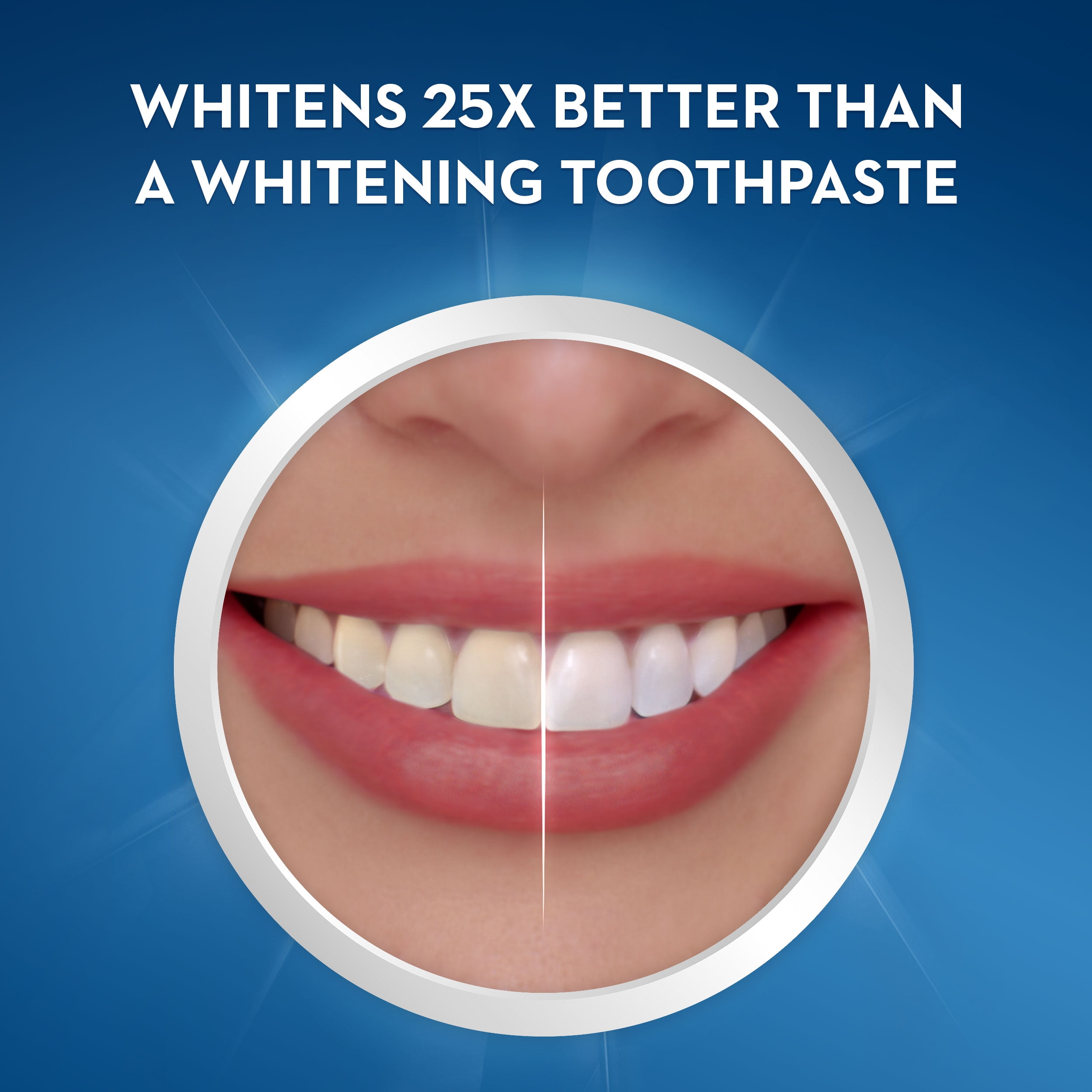 Means for teeth whitening: review, effectiveness, comparison Means for teeth whitening: review, effectiveness, comparison