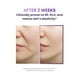 thumbnail image 4 of Set de cuidado de la piel BIOHEAL BOH Probioderm 3D Lifting Size Travel Size, 4 of 8