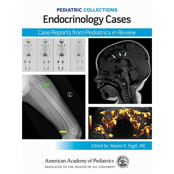 Pediatric Collections Pediatric Collections: Endocrinology Cases: Case Reports from Pediatrics in Review, (Paperback)