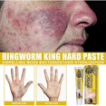thumbnail image 3 of Crema reparadora de piel South Moon Versicolor para manchas de sudor, ungüento de aplicación tópica, crema antipicazón para la piel BF | |, 3 of 5