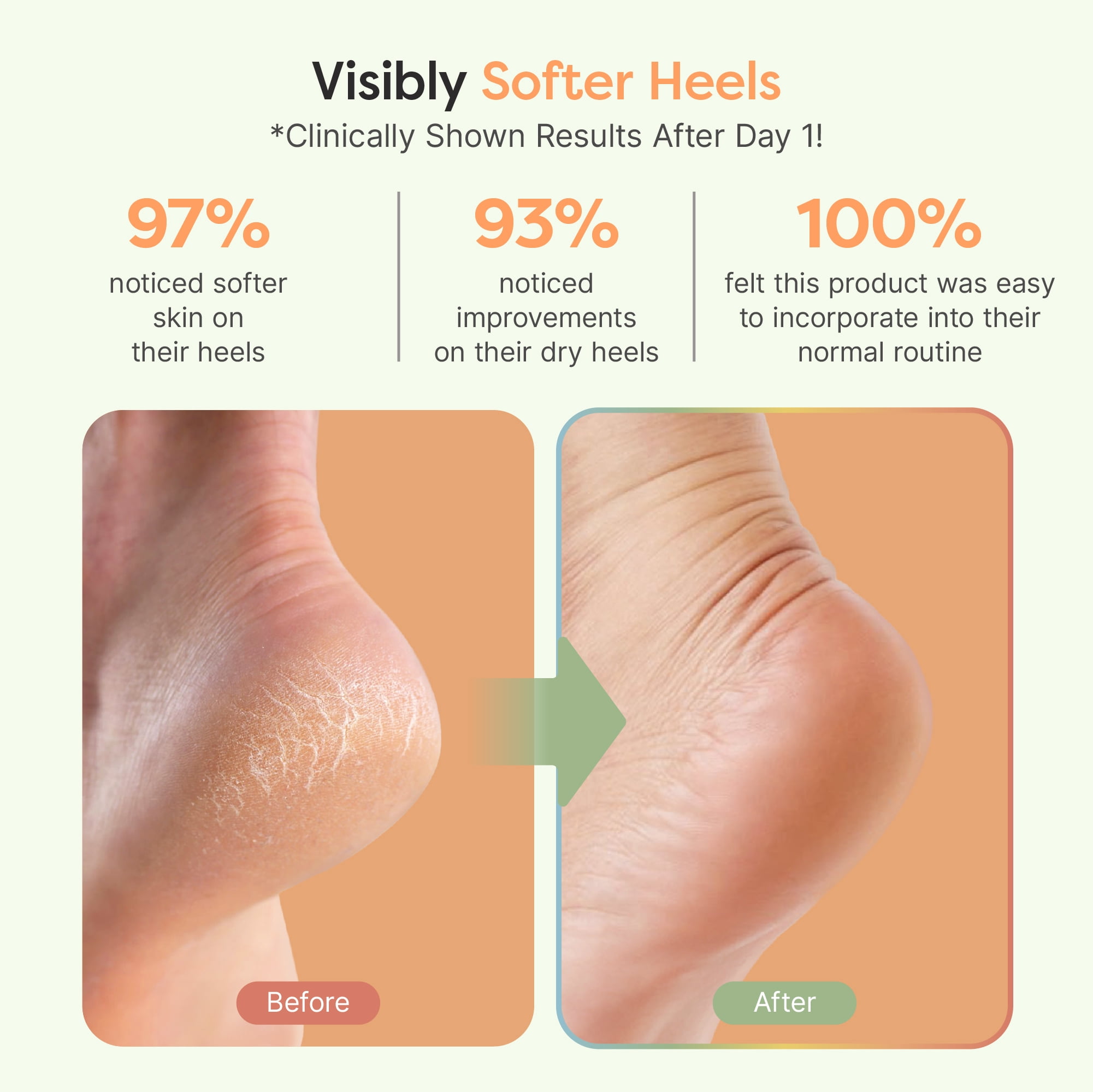(3 pack) ZenToes Moisturizing Gel Heel Socks for Foot Care and Healing