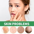 thumbnail image 4 of Green Tea Mask Stick - Deep Pore Cleansing, Blackhead Remover & Skin Brightening for All Skin Types!, 4 of 5