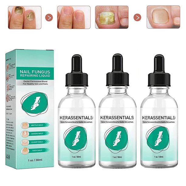 ACRDDK 3pcs Toenail Repair Solution Onychomycosis Repair Solution