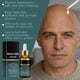 thumbnail image 4 of Pisexur Belleza Maquillaje Suero para el cuidado de la calvicie: hidratante con ácido hialurónico para el cuero cabelludo masculino, alivia la sequedad y protege (30 ml)para mujeres y hombres, 4 of 9