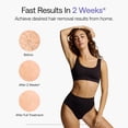 thumbnail image 3 of Depilación IPL Ulike Laser Air 10 para mujeres y hombres, 3 of 8