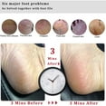 thumbnail image 3 of Foot File Callus Remover Foot Scrubber,Professional Pedicure Foot Rasp Removes Cracked Heels,Dead Skin,Corn,Hard Skin,Pumice Stone for Feet Scraper File Brush Tools for Wet and Dry Feet, 3 of 4