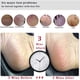 thumbnail image 3 of Removedor de callos para pies, raspador de pies para pedicura profesional que elimina los talones agrietados, piel muerta, maíz, piel dura, piedra pómez para pies, raspador, herramientas de cepil, 3 of 5