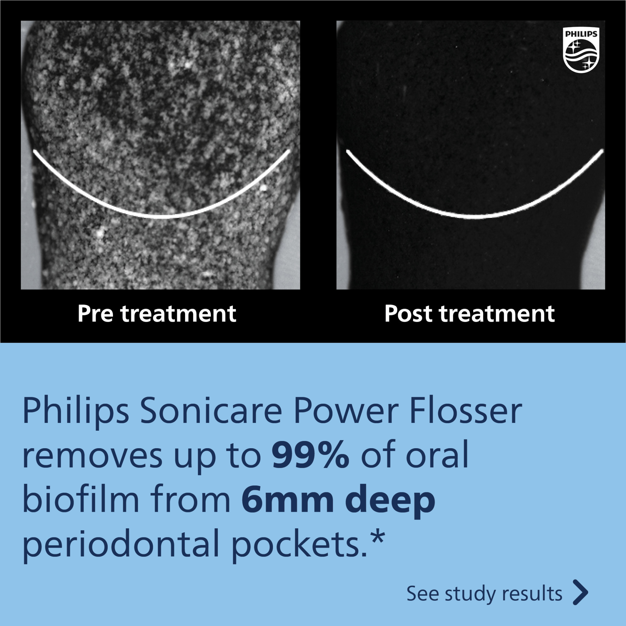 Philips Sonicare Power Flosser 3000 photo 7