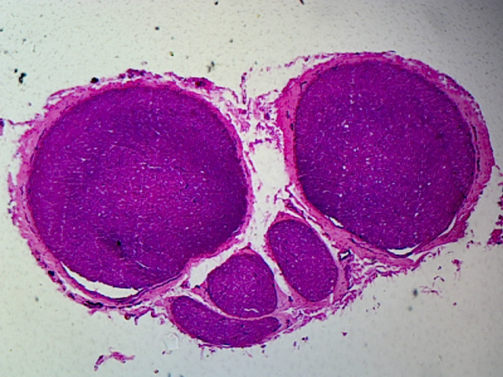 Myelinated Peripheral Nerve, Mammalian; Cross Section by Go Science