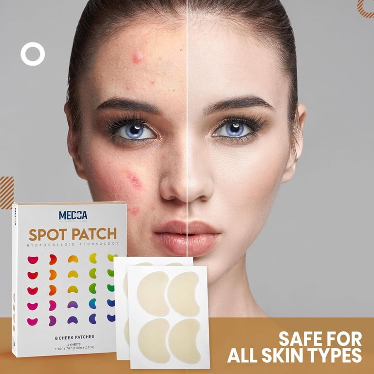 MEDca Cheek Acne Patch – Hydrocolloid Pimple Spot Treatment for