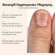 thumbnail image 2 of Bee Venom Nail Soothing Spray, Toe Nail Treatments for Damaged Nails, Nail care, Safely and Gently, 2 of 5