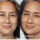 thumbnail image 3 of Sérum de anacardo de Foundation Clinique Even Better Clinical, 3 of 6
