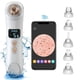 thumbnail image 2 of Aspiradora Removedor De Puntos Negros, Limpiador De Poros Con Succión Facial, Aspiradora De Poros Con Cámara, 5 Potencia De Succión 6 Sondas, Kit Extractor De Comedón Eléctrico WiFi Recargable USB, 2 of 7
