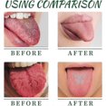 thumbnail image 4 of 1-3X Tongue Repair Spray 30ml Reduce Swelling Tongue Relief Treatment Spray for Bad Breath, Tongue Repair Spray for Dryness& Bad Breath, 4 of 5