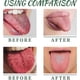 thumbnail image 4 of 1-3X Tongue Repair Spray 30ml Reduce Swelling Tongue Relief Treatment Spray for Bad Breath, Tongue Repair Spray for Dryness& Bad Breath, 4 of 5