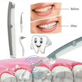 thumbnail image 5 of Electric Sonic Dental Scaler Ultrasonic Tooth Stain Plaque Teeth Clean, 5 of 5