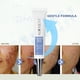 thumbnail image 5 of Buy 2 Get 3 Soft Freckle Extract Acne Removal Marks Facial 20g, 5 of 9