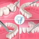 thumbnail image 2 of Espejo Dental de acero inoxidable, juego de herramientas preparadas para dentista, sonda, Kit de cuidado Dental, pinzas de instrumento, escalador Drepanotario de azada, 5 uds., 2 of 5