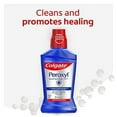 thumbnail image 4 of Colgate Peroxyl Antiseptic Mouth Sore Rinse, Mild Mint - 250mL, 8.45 fluid ounce, 4 of 6