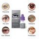 thumbnail image 4 of Gotas oculares rojas, CAIXIN gotas para los ojos 20ml aliviar la fatiga ocular unisex CAIXIN Gotas oculares rojas, 4 of 6