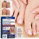 thumbnail image 2 of 60pcs Toenail Fungus Treatment Stickers Ingrowning Toenail Nail Repair Patch, 2 of 5