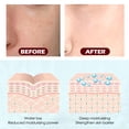 thumbnail image 3 of Glycolic Acid Peel Pads, Moisturizing Salicylic Glycolic Acid Pads 2 Box  For Rough Skin, 3 of 8