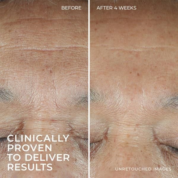 RoC Skincare - Hydratation + Sérum - Acide Hyaluronique + Protéines de Collagène - 30ml Roc Skincare Serum