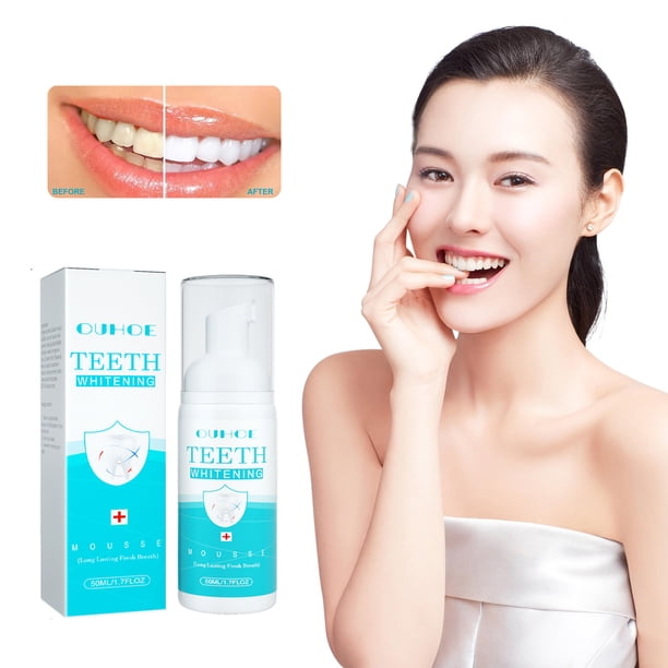 Fiudx Pasta Dental Blanqueadora, Cepillo Dental Forma En U Bebés, Cuidado Bucal, Quita Manchas Natural para Una Sonrisa Radiante, Limpiador Dental de Espuma Ultrafina, Previene Caries y Encías, Apto