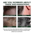 thumbnail image 3 of Head Moss Anti-Itching Shampoo Hair Oil Control Scalp Cleaning Anti-Dandruff Anti-Itching Refre, 3 of 4