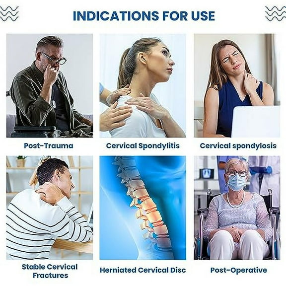 Ossur Miami J Cervical Neck Collar - Neck Brace for Pain Relief & Support | Cervical Collar for Neck Pain and Support | Semi-Rigid Pads | Spine Immobilizer | MJ-200 / Kyphotic