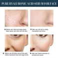 thumbnail image 2 of Protein Lift Line Skin Anti-wrinkle V-face Firming Li, 2 of 5