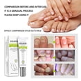thumbnail image 4 of Nail Repair Gel Quickly Improves The Appearance Of Infected/cracked Nails, 4 of 4
