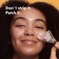 thumbnail image 2 of Hidrocoloide Pore Strips Hero Cosmetics Mighty Patches XL, 2 of 9